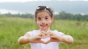 البهاق وعلاجه